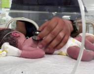 Sabreen murió, pero su bebé logró sobrevivir.