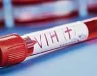 El número de nuevos casos diagnosticados cayó un 24% en 2020 respecto al año anterior, pero aún así se registraron 104.765 infecciones en 46 de los 53 países.