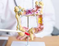 Imagen referencial de la anatomía del cólon.