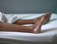 El síndrome de Guillain-Barré paraliza los músculos, pero la mayoría de las personas que lo contraen eventualmente se recuperan.