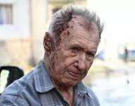 Este hombre, herido por los bombardeos en Chugúyev, espera ser atentido por los servicios de emergencia.