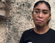 Esmeralda Millán sufrió un ataque de ácido en Puebla, México.