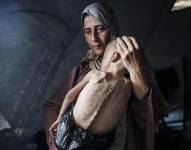 La historia de la foto de Hedaya y su bebé, una de las imágenes más impactantes de la hambruna en Gaza