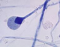 Lo llaman el hongo negro y en India es considerado una pesadilla dentro de la pandemia de coronavirus.