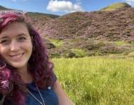 Ailsa se sometió al mismo tratamiento que la modelo Linda Evangelista