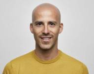 3 mitos persistentes sobre la calvicie, según una experta de la Universidad de California