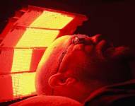 Terapia fotodinámica: el prometedor tratamiento que combate el cáncer con luz