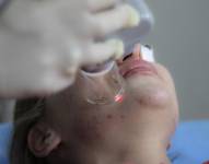 El uso de la Inteligencia Artificial en la piel.