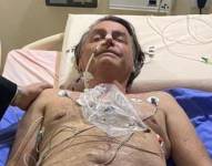 Jair Bolsonaro fue internado en un hospital de Sao Paulo.