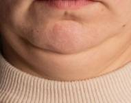 Si tu cuello se ve más grueso o más delgado de lo habitual, puede indicar algunos problemas de salud.