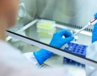 La Cartera de Salud ha identificado hasta el momento 120 personas sospechosas.