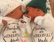 Lydia Ann y Timothy Ronald Ridgeway nacieron el 31 de octubre de 2022.