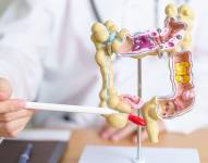 Imagen referencial: Anatomía del colon.