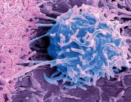 Las bacterias y hongos también viven en los tumores.
