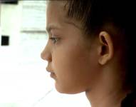 Imagen de una niña paciente de una enfermedad rara.