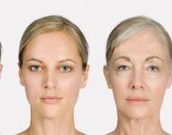 Las arrugas reflejan mucho más que el paso de los años.