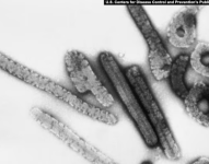 El virus de Marburgo causa una fiebre hemorrágica viral altamente infecciosa.