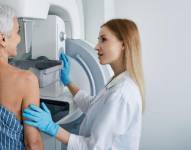 Las mamografías se utilizan para detectar cánceres de mama.