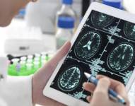 Estudios científicos han demostrado cambios en el cerebro en pacientes que han tenido covid-19.