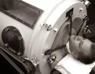 En el siglo pasado, el uso de los pulmones de acero era muy com'un para ayudar a pacientes de polio.