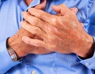 Muchos signos previos al infarto pasan desapersividos por los afectados.