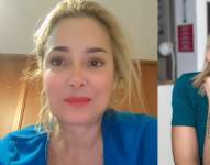 Marián Sabaté durante el video en el que reveló la cirugía a la que se sometería.