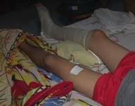 Adolescente baleado en Guayaquil se recupera en su casa