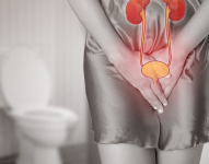 Imagen referencial. Infección de orina.