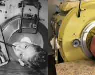 Paul Alexander muere tras estar 70 años viviendo en un pulmón de acero