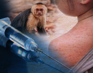 Según datos del Miniseterio de Salud, dos niños se infectaron con la viruela del mono en Ecuador.