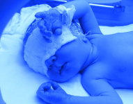 Imagen referencial de un neonato.