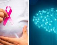 Fotos referenciales del cáncer de mama y la inteligencia artificial.