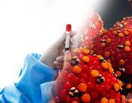 El primer caso sospechoso viruela del mono corresponde a un paciente que vino desde África.