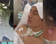 Carlos Ortuño quedó cuadrapléjico tras un ataque armado.