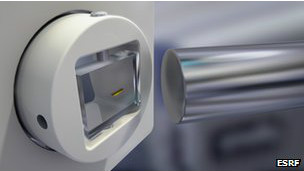 Los riesgos de la cirugía bariátrica