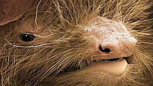 Los riesgos de la cirugía bariátrica