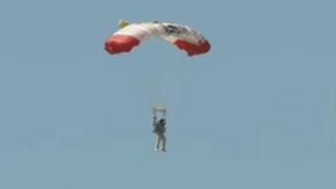 Los riesgos de la cirugía bariátrica