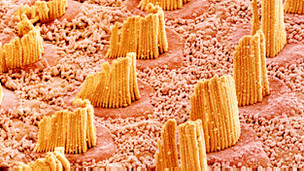 Los riesgos de la cirugía bariátrica