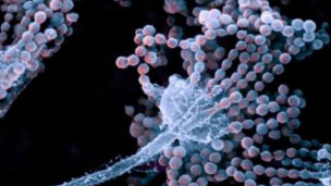 Más fármacos contaminados en brote de meningitis