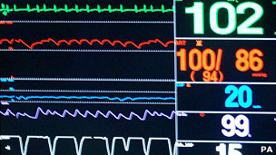 Los virus informáticos: una amenaza seria contra la tecnología médica