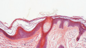 ¿Se puede hipnotizar a un bebé para que duerma?