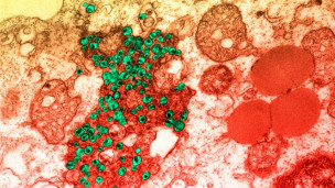 &quot;Sí es posible encontrar una cura para el VIH&quot;, dice premio Nobel
