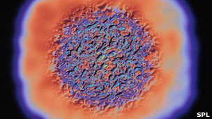 Los riesgos de la cirugía bariátrica