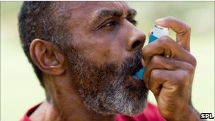 Investigan vínculo entre infecciones virales en los recién nacidos y el asma