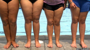 Regresa la gota, la &quot;enfermedad de los reyes&quot;