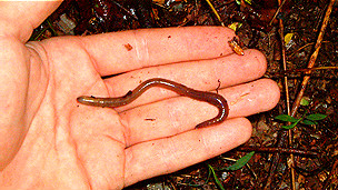 Los riesgos de la cirugía bariátrica