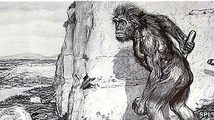 Los riesgos de la cirugía bariátrica