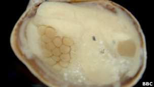 Los riesgos de la cirugía bariátrica