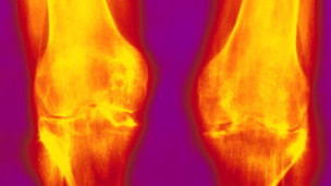 Los remedios que no necesitamos