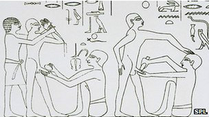 Circuncisión: ¿cortar o no cortar? Ése es el dilema